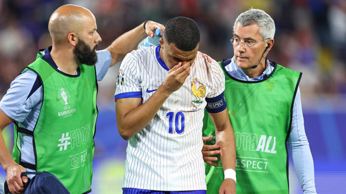 france fear for bloodied kylian mbappe's nose as didier deschamps handles adversity ahead of netherlands game