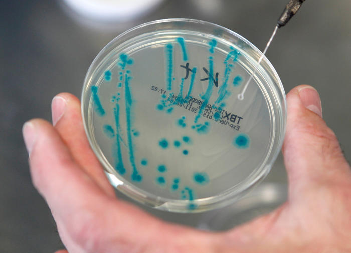 médicos y científicos creen haber encontrado la razón tras mortal avance de la “bacteria asesina”