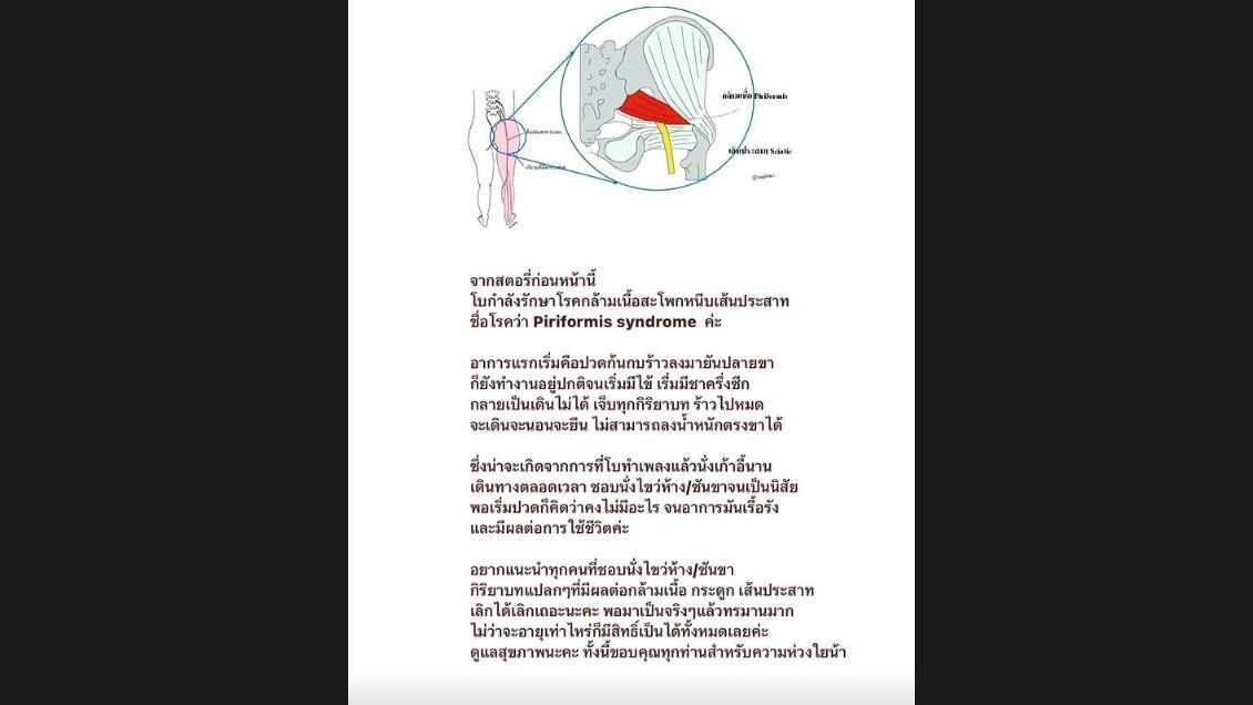 โบกี้ไลอ้อน แนะเลิกได้เลิก พฤติกรรมนี้ หลังป่วยกล้ามเนื้อสะโพกหนีบเส้นประสาท