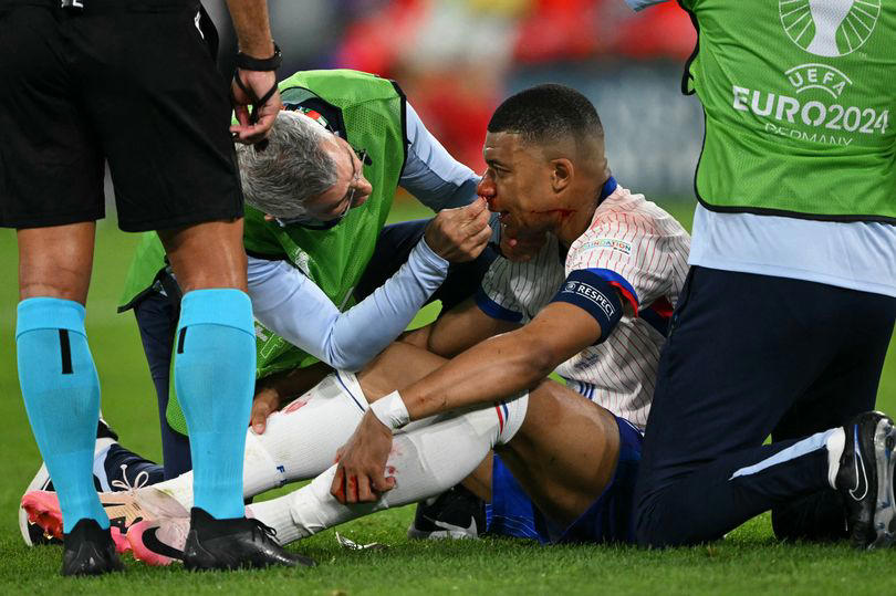 kylian mbappe injury: netherlands decision made as france boss confirms surgery