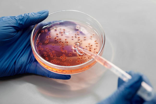 flesh-eating bacteria that can kill you in 48 hours on the rise in japan