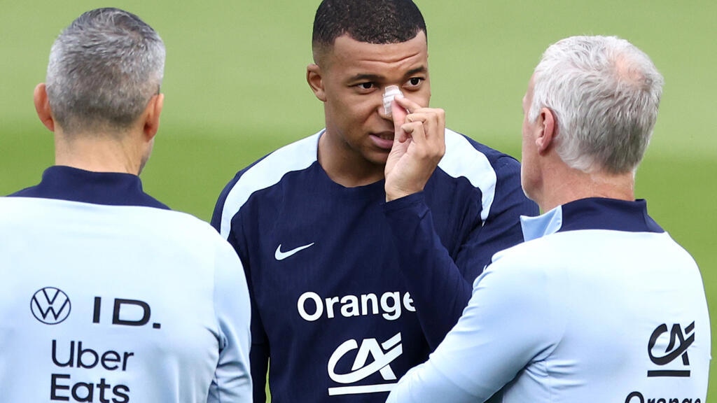 mbappe injury compels france to rethink euro 2024 game plan