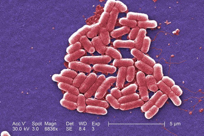 e. coli: first death in england linked to ongoing outbreak of bacteria