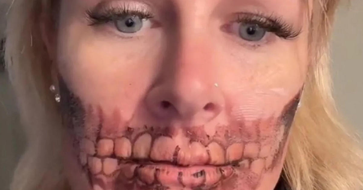 kvinde fik lavet skræmmende halloween-tatovering: da hun skulle fjerne den, gik hun i panik