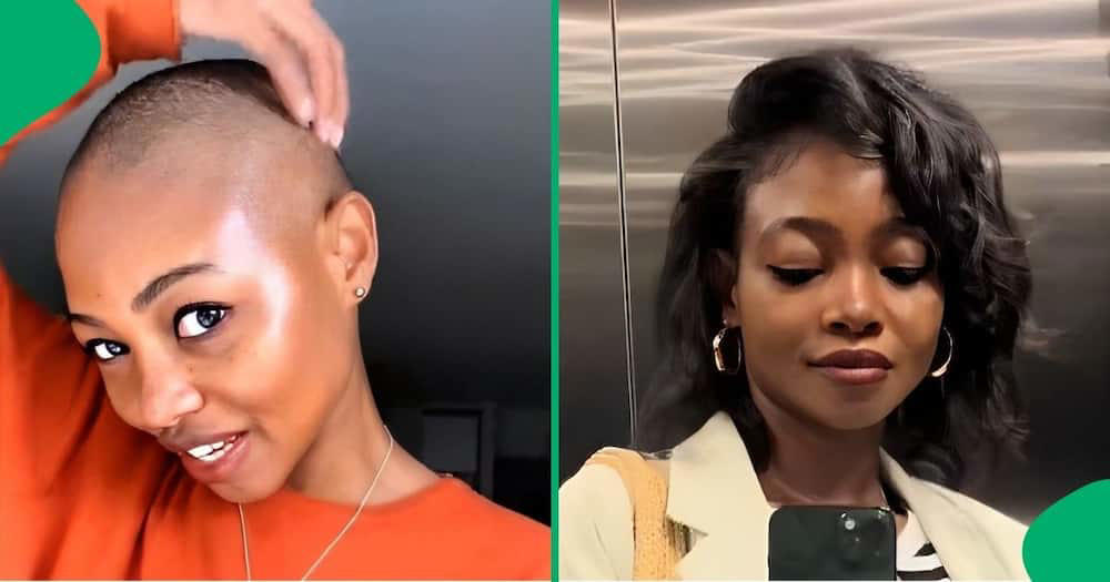 watch: woman shares hair growth serums she used on bald head