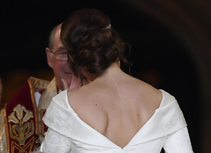 princess eugenie shows off scars from scoliosis surgery in new post supporting sufferers