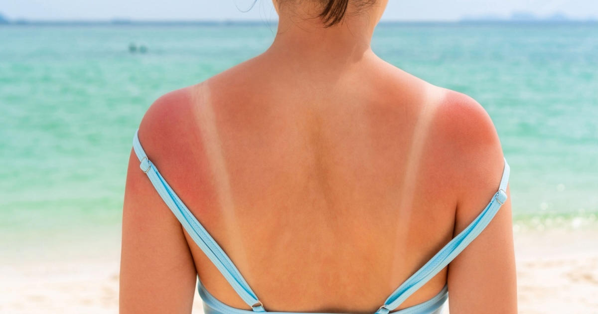 mange danskere undrer sig: kan man stadig blive brun, når man bruger solcreme?