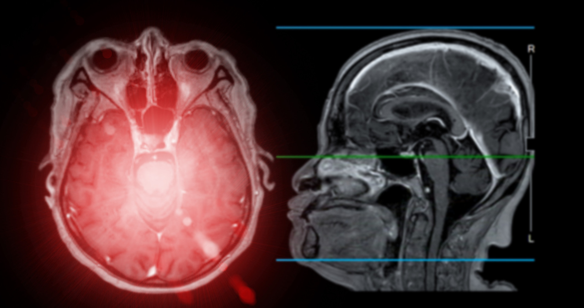 Recognizing the warning signs of a stroke