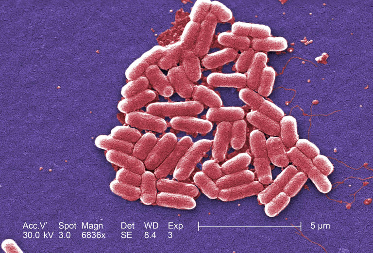 Legal action started against Tesco and Asda over E. coli outbreak