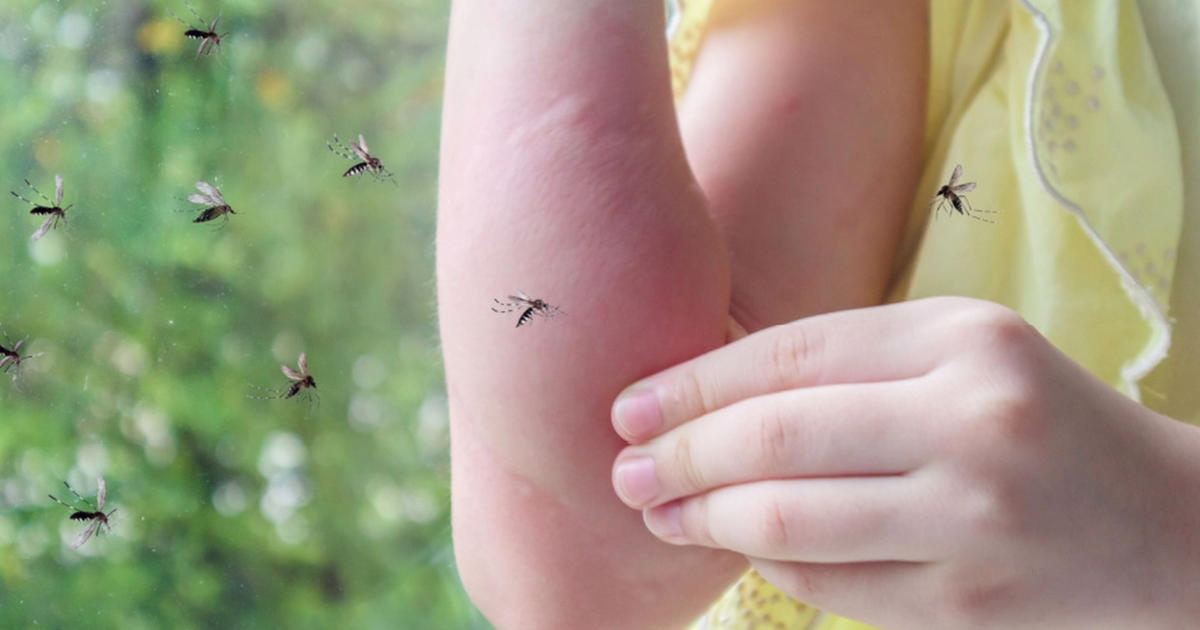 många undrar: här är anledningen till varför myggorna alltid väljer dig