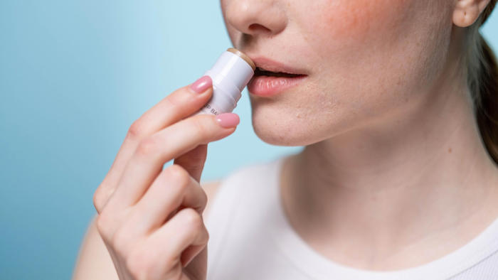 how to, chapped lips guide: what causes dry lips, how to treat them and what you should avoid