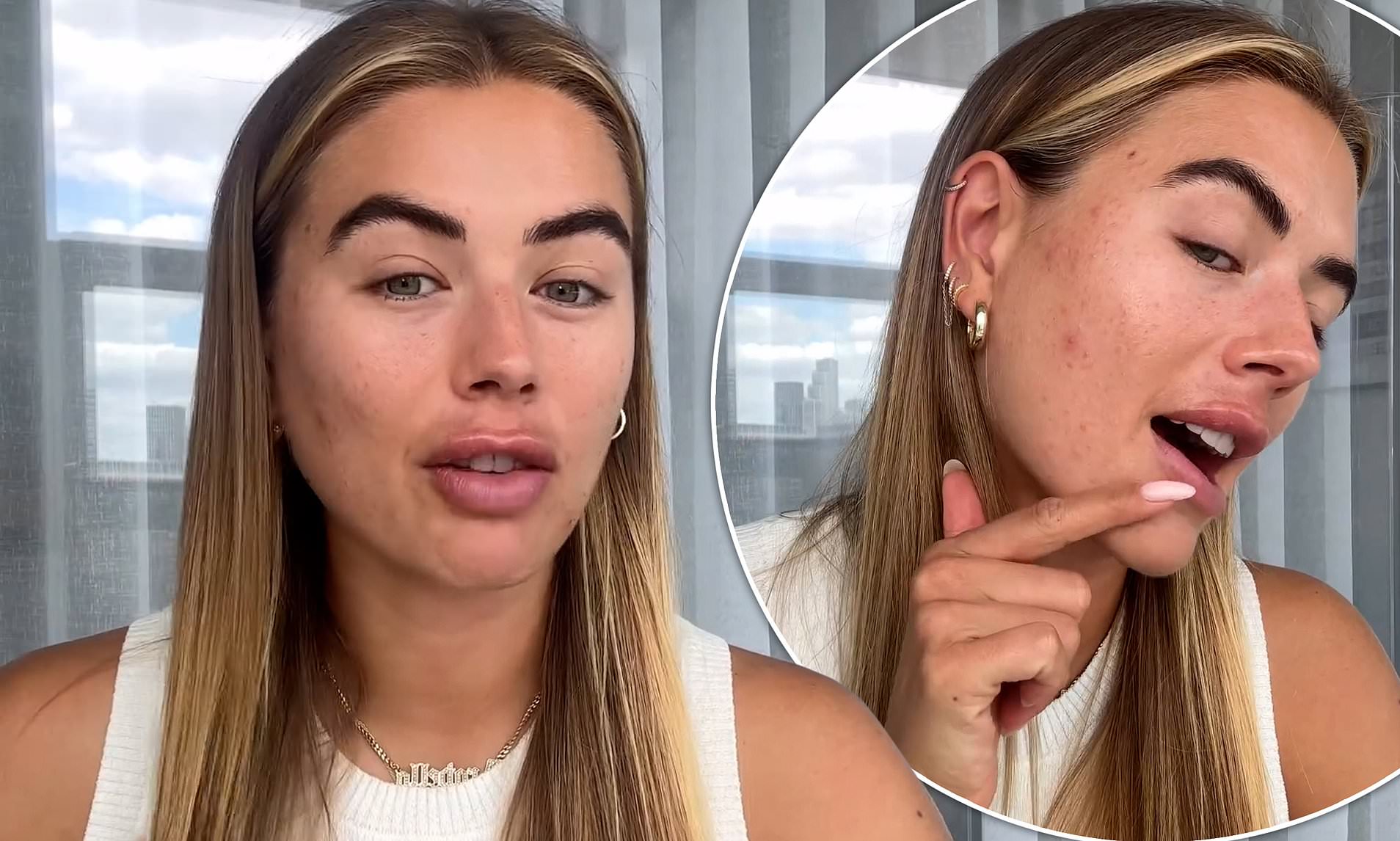 Love Island's Arabella Chi Reveals She's Been Diagnosed With PCOS After ...