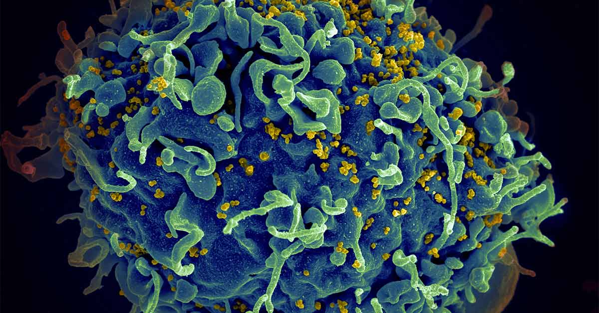 HIV Breakthrough: Drug Trial Shows Injection Twice A Year Is 100% ...