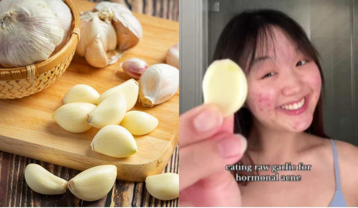 viraalivideo tiktokissa: ihmiset syövät raakaa valkosipulia parantaakseen aknea