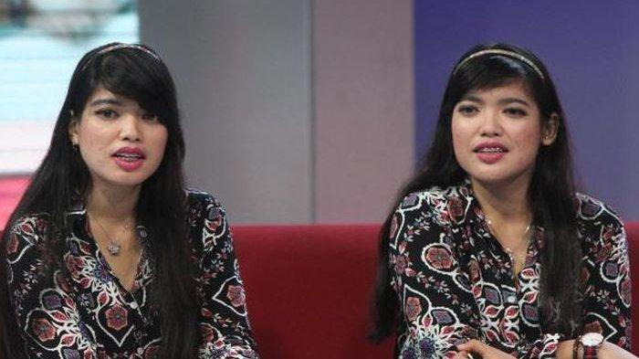 ingat bayi kembar siam pertama berhasil dioperasi di indonesia? kabar yuliana dan yuliani sekarang