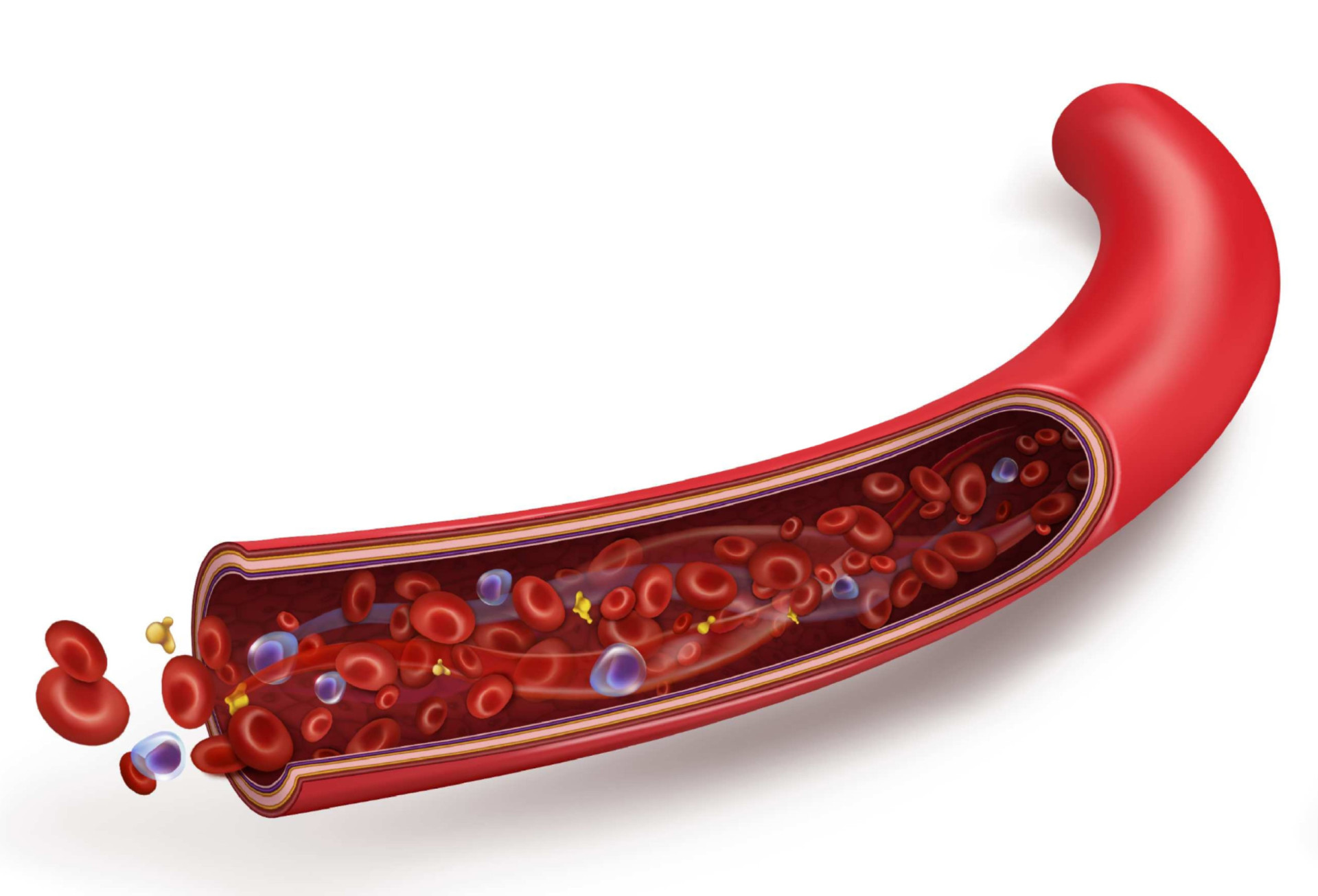 Everything You Need To Know About Multiple Sclerosis