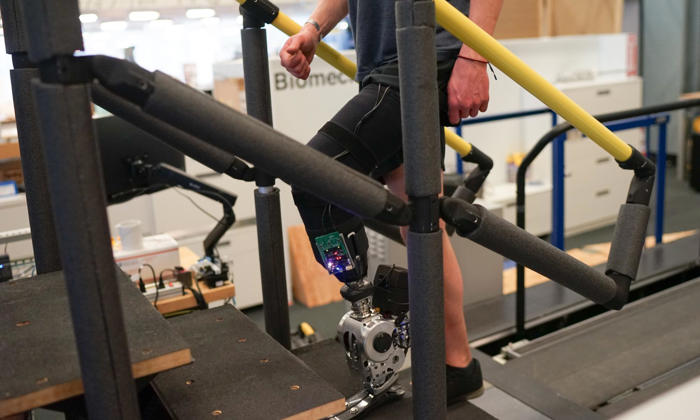 bionic leg makes walking quicker and easier for amputees, trial shows