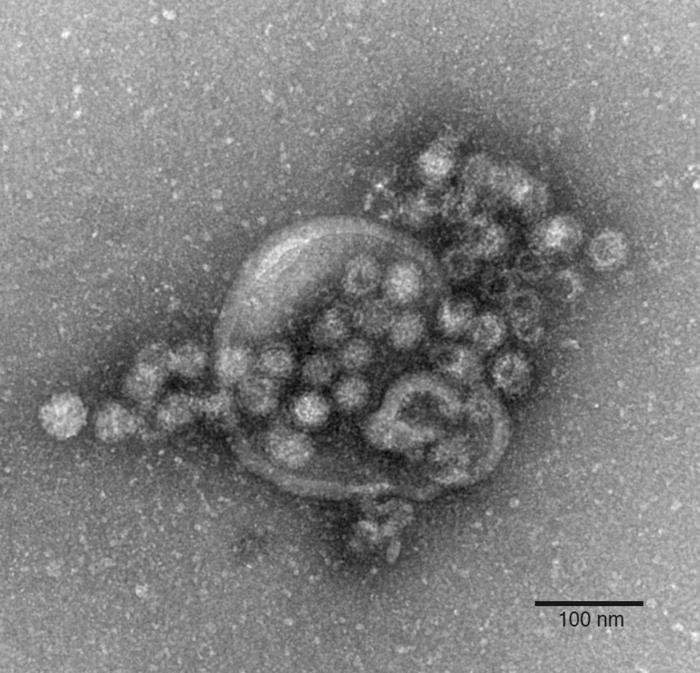 norovirus am gardasee - hunderte menschen im krankenhaus