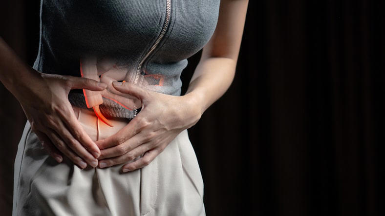 5 causas de la apendicitis que pueden terminar en peritonitis rápidamente