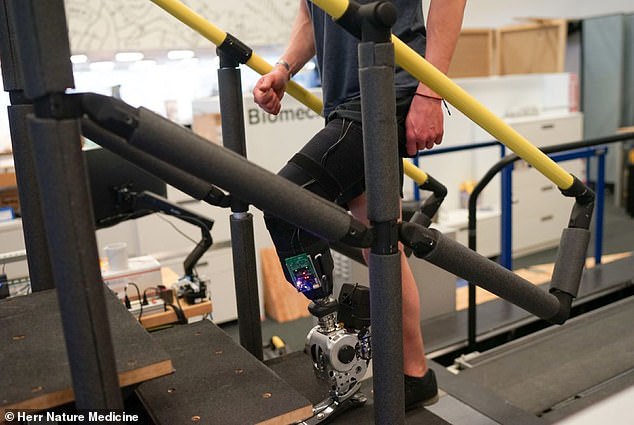 Bionic Breakthrough: Prosthetic Leg Is Controlled By Human Thoughts