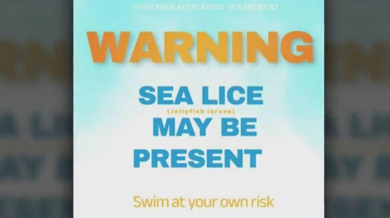 Rash-causing sea lice reported at NJ bay beaches