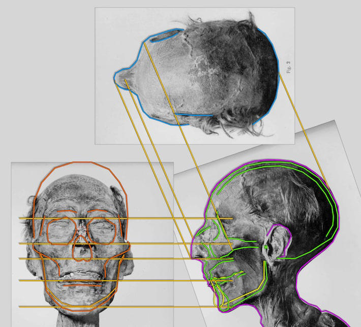 Estudo comparou projeções anteriores de Ramsés com dados virtuais da fisionomia de um doador Foto: Reprodução/OrtogOnLineMag