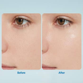 Close-up of a person's cheek and eye area, showing a