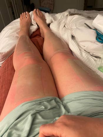 reviewer with patches on legs