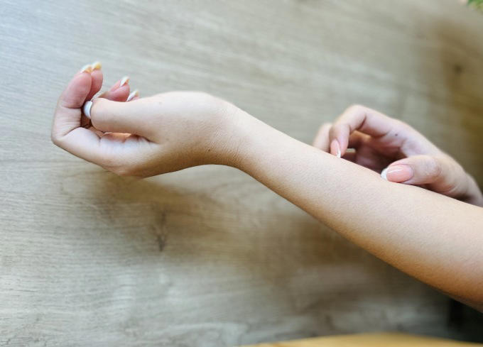 Người bệnh thận thường bị ngứa da ở phần ngực, mặt và tay chân. Ảnh: Ngọc Phạm