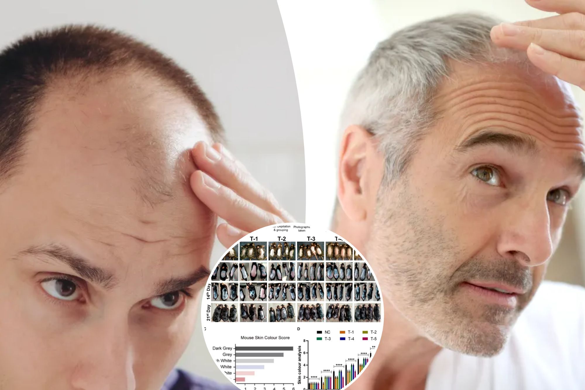 A Breakthrough For Baldness? Sugar Gel Stimulates Hair Regrowth