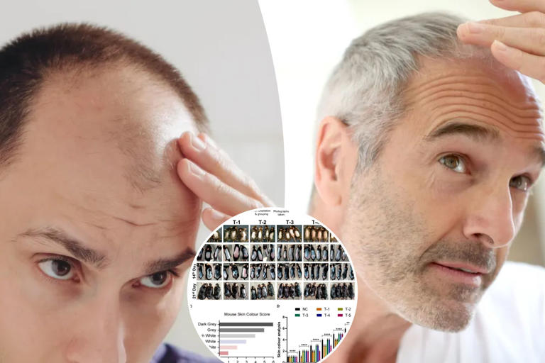 A breakthrough for baldness? Sugar gel stimulates hair regrowth