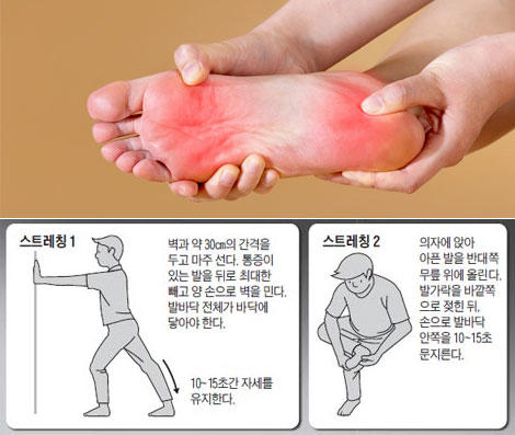 아침에 유독 아픈 발바닥, '이 스트레칭'하면 90% 개선