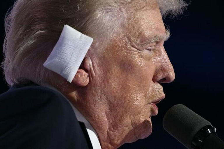 Trump makes drastic ear bandage change as JD Vance admits he hasn't seen the wound