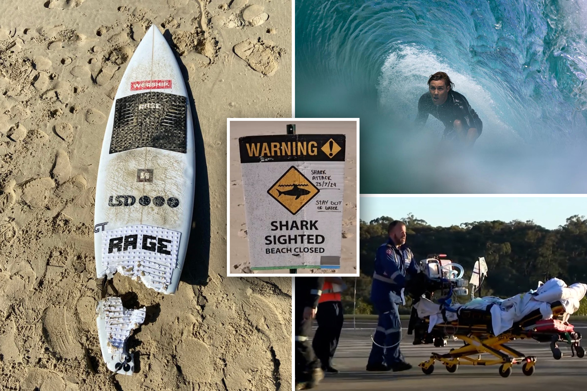 Surfer’s Leg Washes Up After Shark Attack, Doctors Scramble To Reattach It