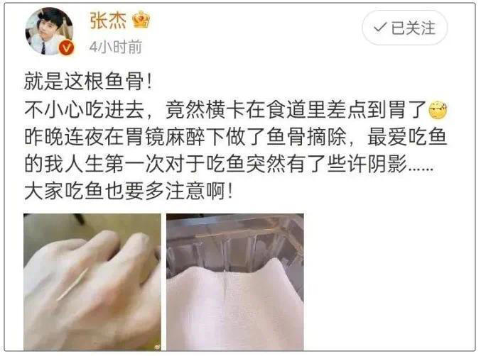 用镊子拔出卡喉的鱼刺，张杰这个操作冲上热搜！适合所有人吗？