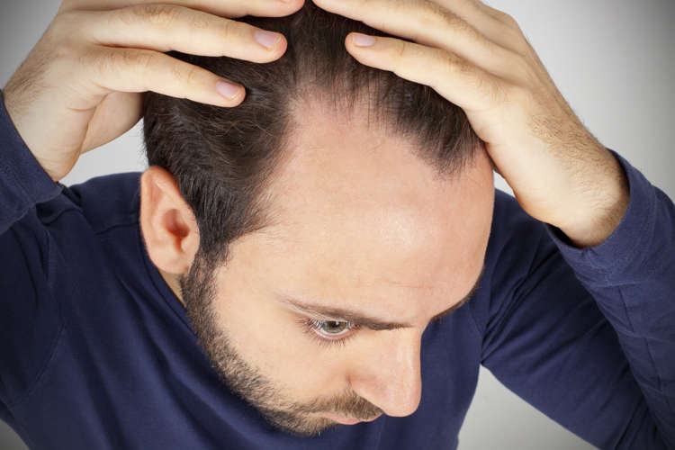 15 facts about hair loss