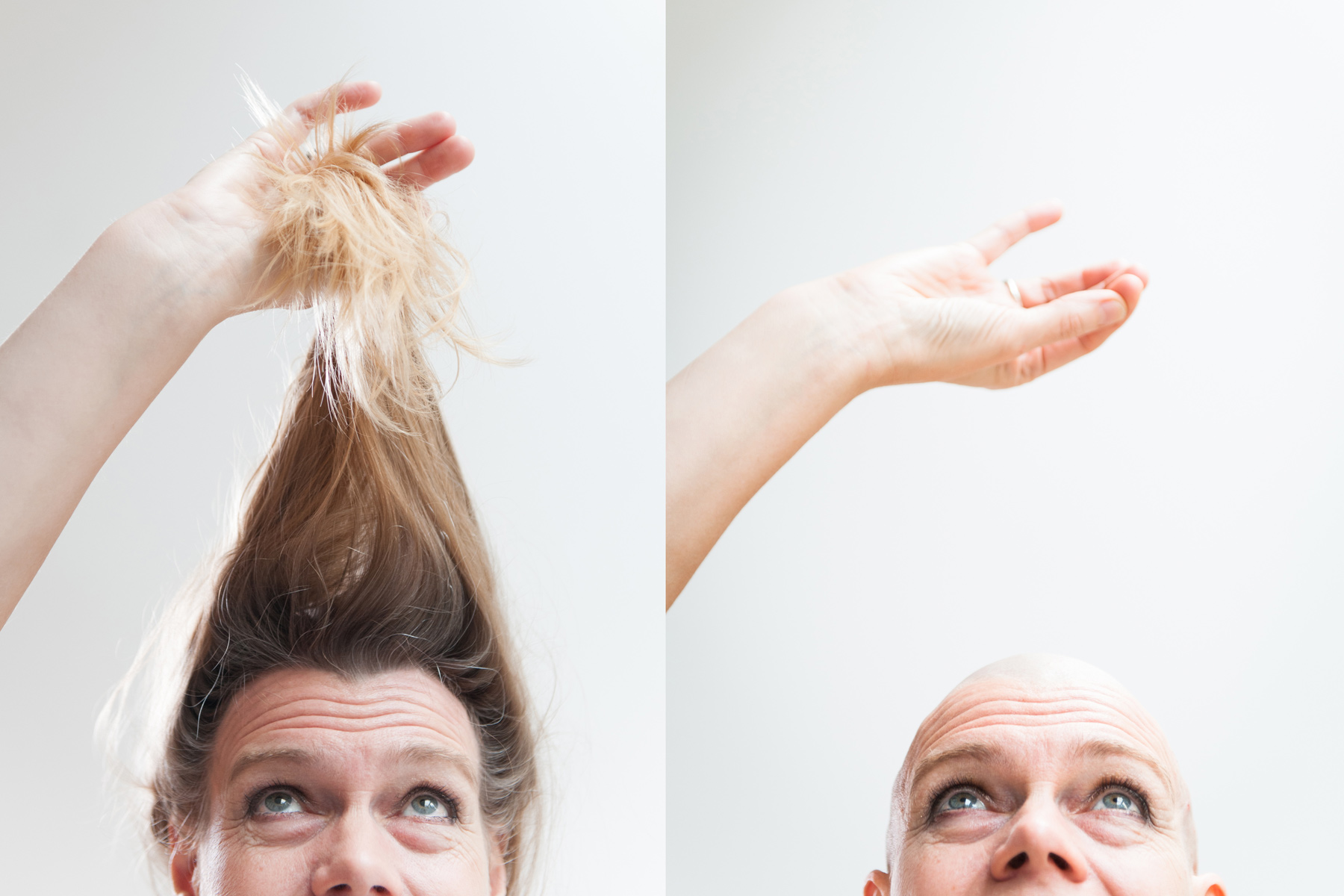 15 facts about hair loss