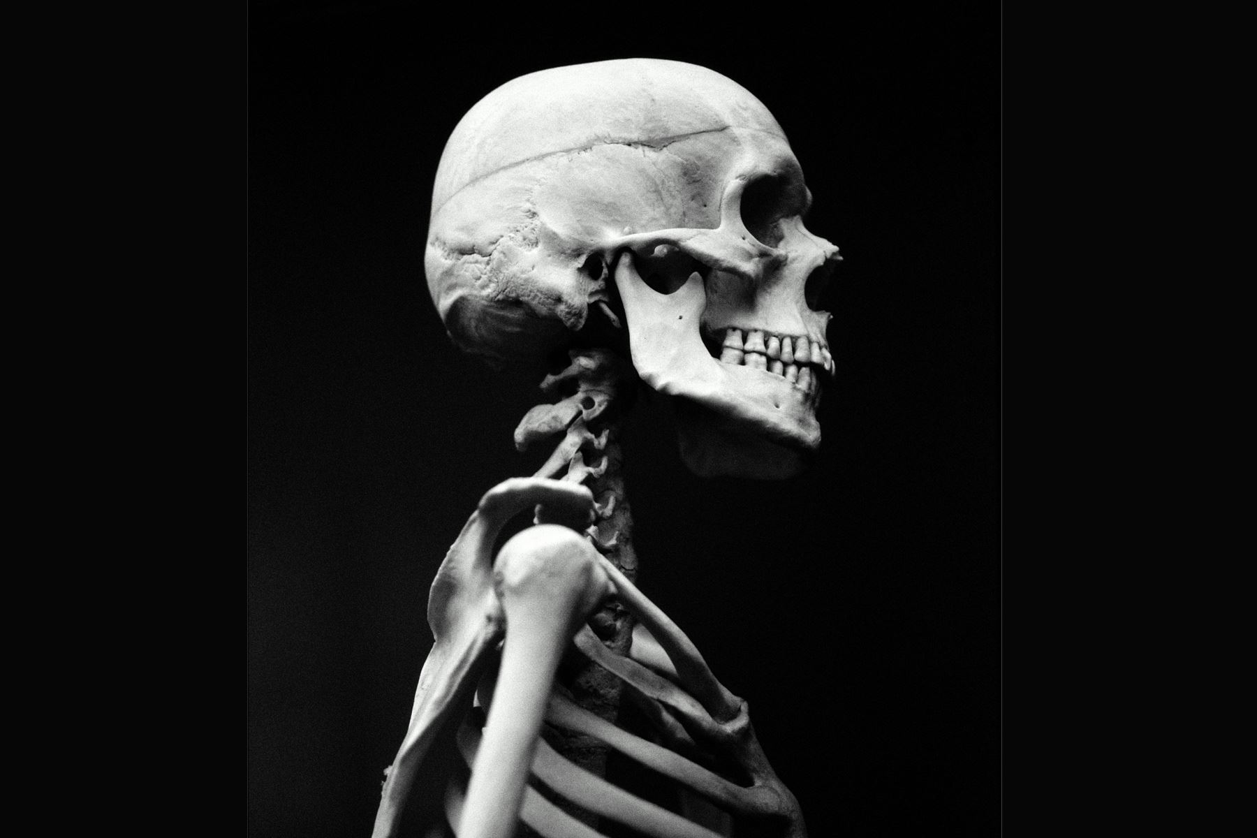 Slide 5 de 21: Youâre born with more than 300 bones but by the time youâre an adult you have just 206. This is because some of the bones fuse together.