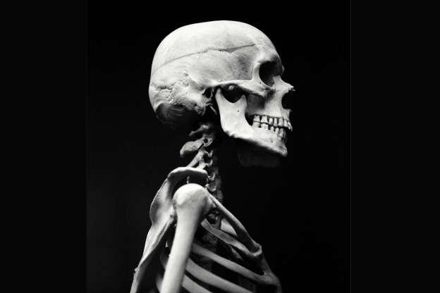 Slide 5 de 21: Youâ€™re born with more than 300 bones but by the time youâ€™re an adult you have just 206. This is because some of the bones fuse together.