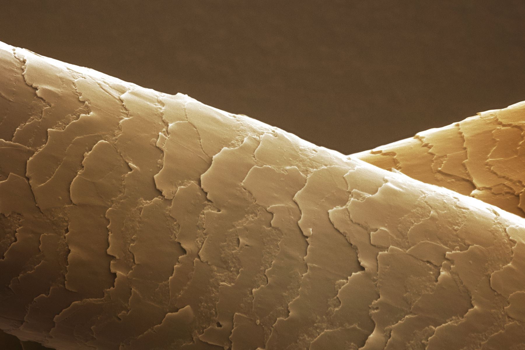 Slide 12 de 21: Your hair grows about 6mm (1/4 inch) every four weeks and keeps on growing for up to six years. The hair then falls out and another grows in its place.