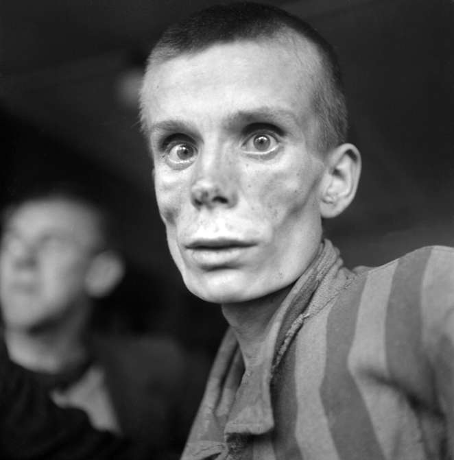 Slide 45 de 100: Picture dated 1945 showing a young Russian, aged 18, after the liberation of Dachau concentration camp in Germany, the first opened by the Nazis, in 1933, where more than 30,000 people died.