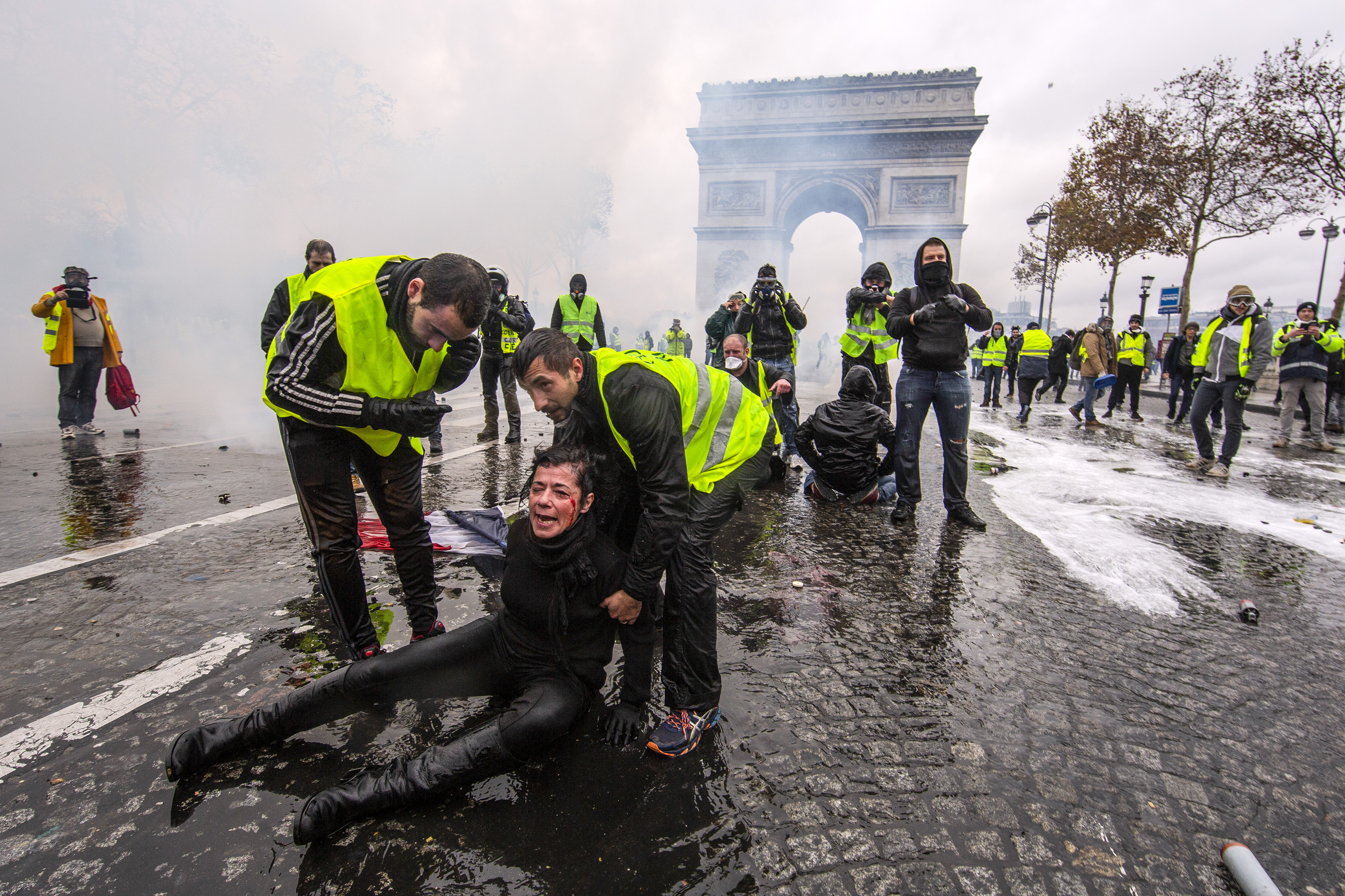 Slide 6 of 36: A protester is wounded by a water canon as they clash with riot police during a 'Yellow Vest' demonstration near the Arc de Triomphe on Dec. 1, in Paris, France.