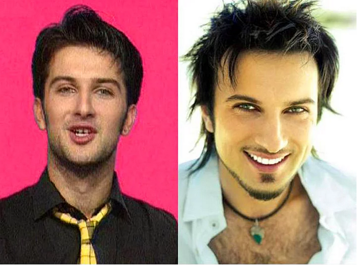 Певец таркан до и после фото Таркана в молодости и сейчас фото